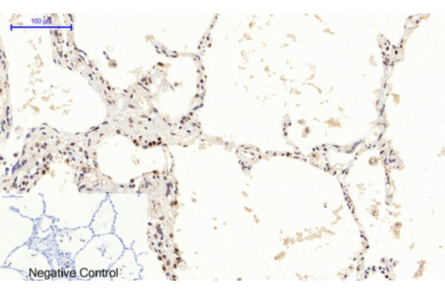 Immunohistochemistry - Anti-mTOR (phospho Ser2448) Antibody (A7156) - Antibodies.com