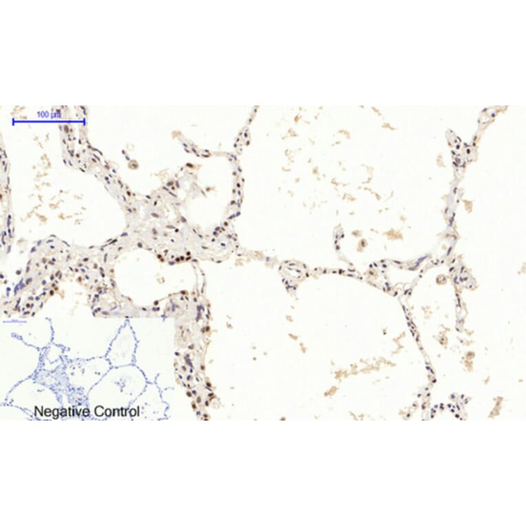 Immunohistochemistry - Anti-mTOR (phospho Ser2448) Antibody (A7156) - Antibodies.com