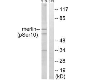 Western Blot - Anti-Merlin (phospho Ser10) Antibody (A8046) - Antibodies.com