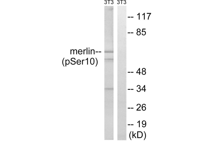 Western Blot - Anti-Merlin (phospho Ser10) Antibody (A8046) - Antibodies.com