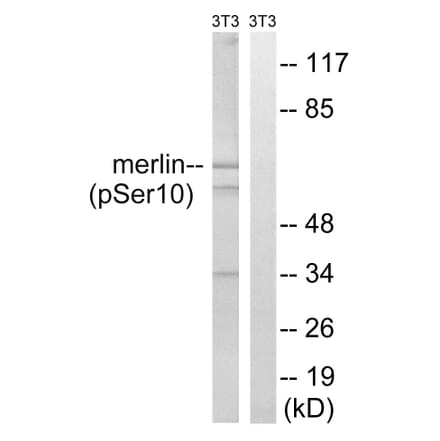 Western Blot - Anti-Merlin (phospho Ser10) Antibody (A8046) - Antibodies.com