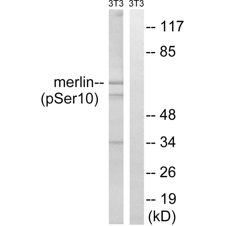 Western Blot - Anti-Merlin (phospho Ser10) Antibody (A8046) - Antibodies.com
