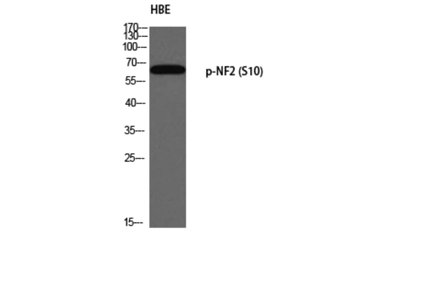 Western Blot - Anti-Merlin (phospho Ser10) Antibody (A8046) - Antibodies.com
