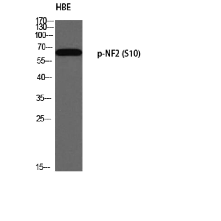 Western Blot - Anti-Merlin (phospho Ser10) Antibody (A8046) - Antibodies.com