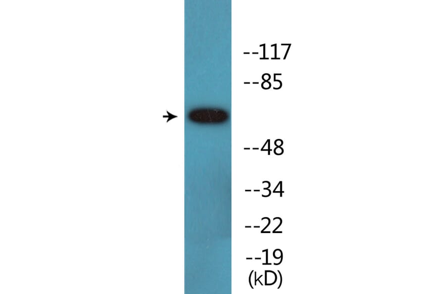 Western Blot - Anti-Merlin (phospho Ser10) Antibody (P12-1148) - Antibodies.com