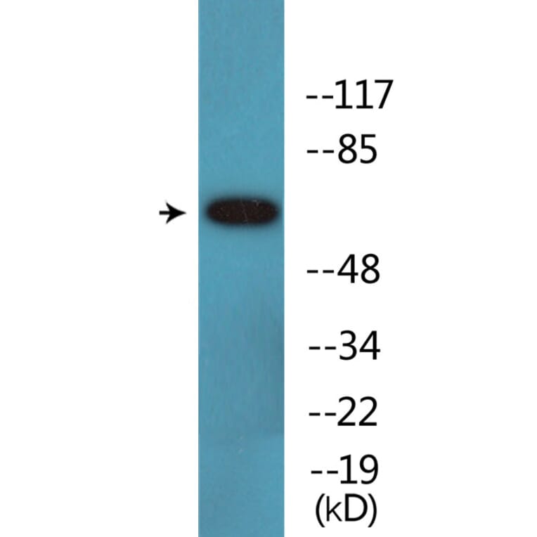 Western Blot - Anti-Merlin (phospho Ser10) Antibody (P12-1148) - Antibodies.com
