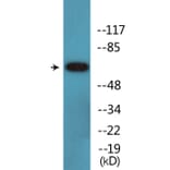 Western Blot - Anti-Merlin (phospho Ser10) Antibody (P12-1148) - Antibodies.com