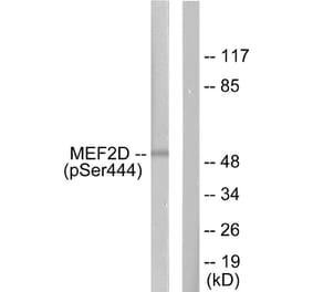 Western Blot - Anti-MEF2D (phospho Ser444) Antibody (A0510) - Antibodies.com