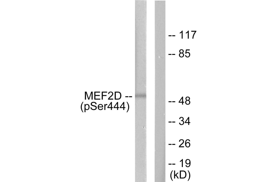Western Blot - Anti-MEF2D (phospho Ser444) Antibody (A0510) - Antibodies.com