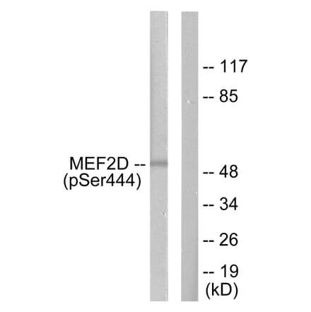 Western Blot - Anti-MEF2D (phospho Ser444) Antibody (A0510) - Antibodies.com