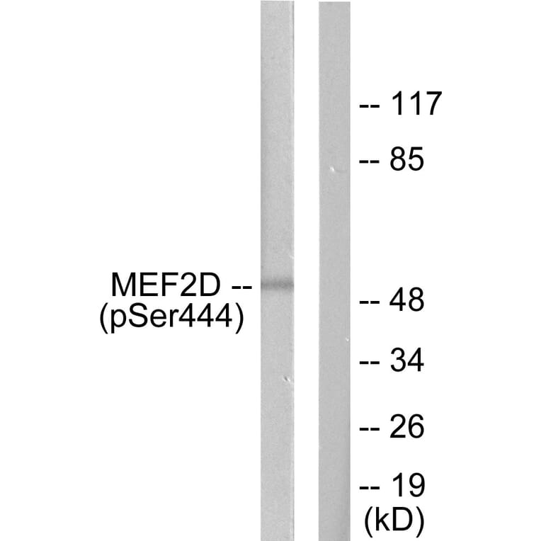 Western Blot - Anti-MEF2D (phospho Ser444) Antibody (A0510) - Antibodies.com