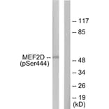 Western Blot - Anti-MEF2D (phospho Ser444) Antibody (A0510) - Antibodies.com