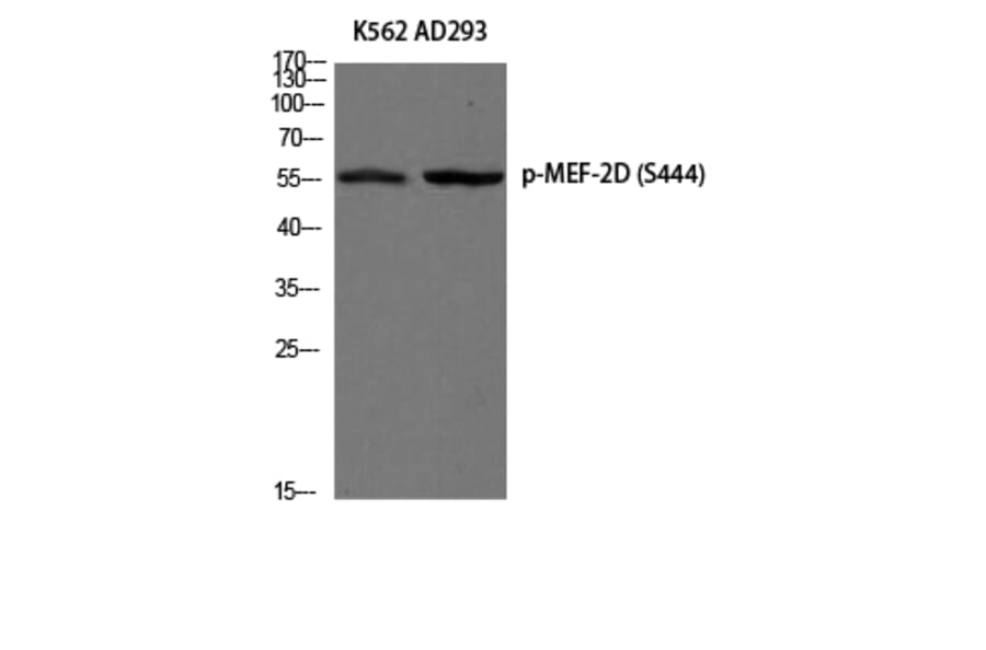 Western Blot - Anti-MEF2D (phospho Ser444) Antibody (A0510) - Antibodies.com