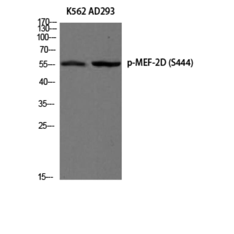 Western Blot - Anti-MEF2D (phospho Ser444) Antibody (A0510) - Antibodies.com