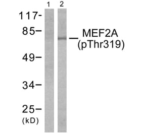 Western Blot - Anti-MEF2A (phospho Thr319) Antibody (A7145) - Antibodies.com