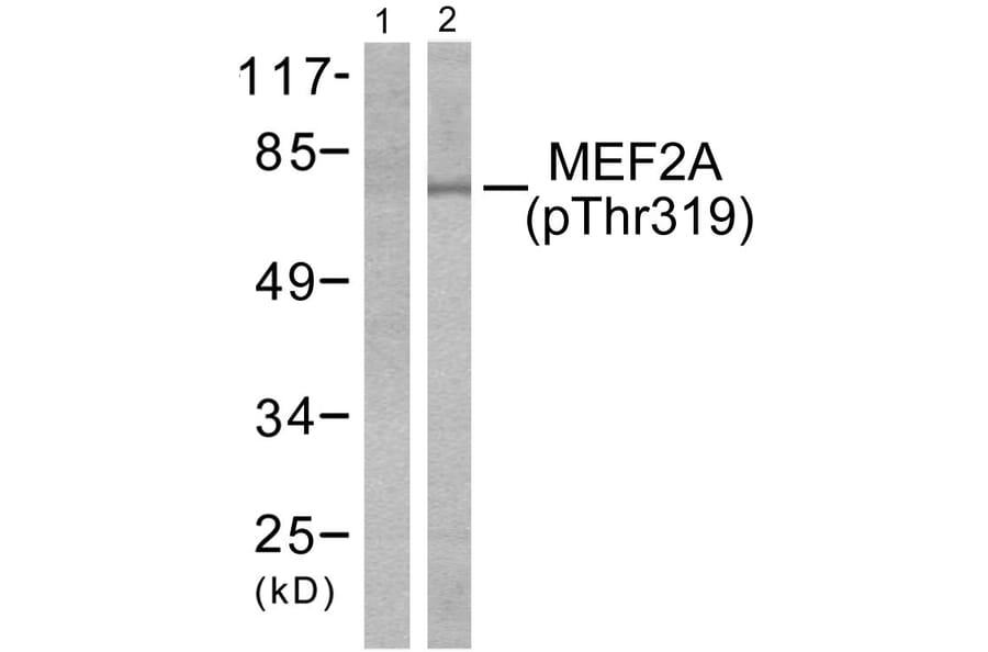 Western Blot - Anti-MEF2A (phospho Thr319) Antibody (A7145) - Antibodies.com