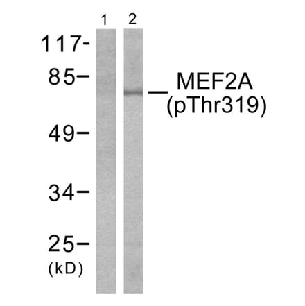 Western Blot - Anti-MEF2A (phospho Thr319) Antibody (A7145) - Antibodies.com