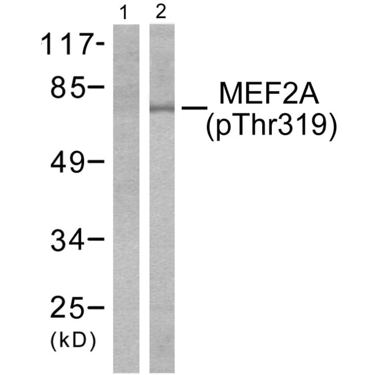 Western Blot - Anti-MEF2A (phospho Thr319) Antibody (A7145) - Antibodies.com