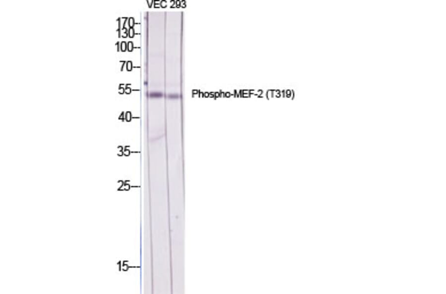 Western Blot - Anti-MEF2A (phospho Thr319) Antibody (A7145) - Antibodies.com
