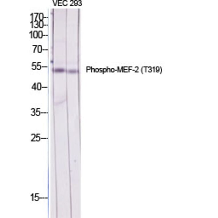 Western Blot - Anti-MEF2A (phospho Thr319) Antibody (A7145) - Antibodies.com