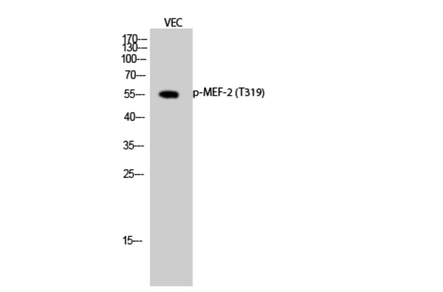 Western Blot - Anti-MEF2A (phospho Thr319) Antibody (A7145) - Antibodies.com