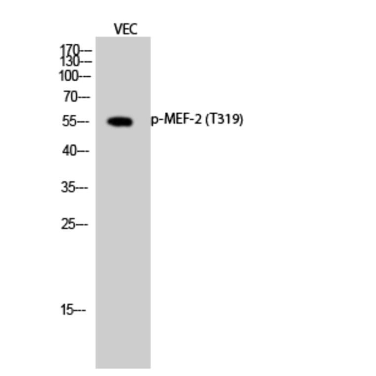 Western Blot - Anti-MEF2A (phospho Thr319) Antibody (A7145) - Antibodies.com