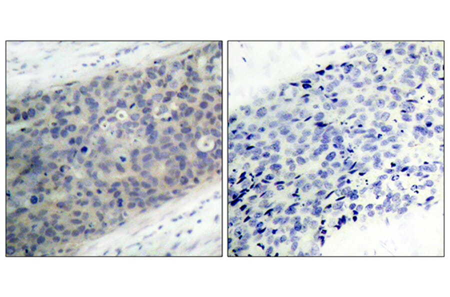 Immunohistochemistry - Anti-LIMK2 (phospho Thr505) Antibody (A7141) - Antibodies.com