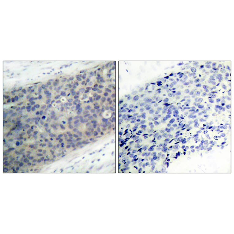 Immunohistochemistry - Anti-LIMK2 (phospho Thr505) Antibody (A7141) - Antibodies.com