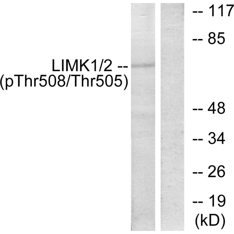 Western Blot - Anti-LIMK2 (phospho Thr505) Antibody (A7141) - Antibodies.com