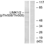 Western Blot - Anti-LIMK2 (phospho Thr505) Antibody (A7141) - Antibodies.com