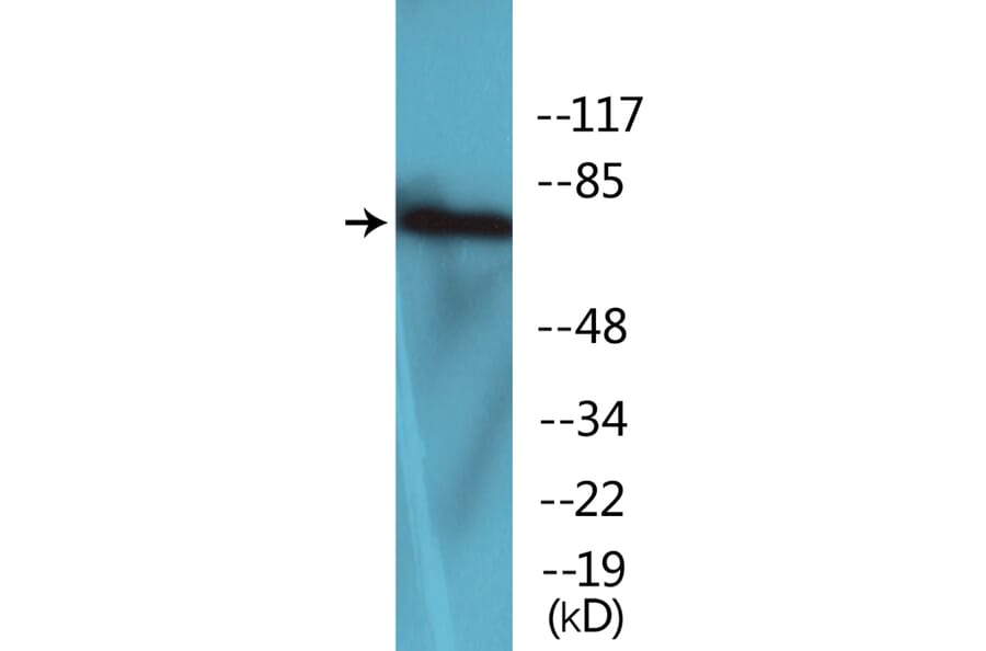 Western Blot - Anti-LIMK2 (phospho Thr505) Antibody (P12-1137) - Antibodies.com