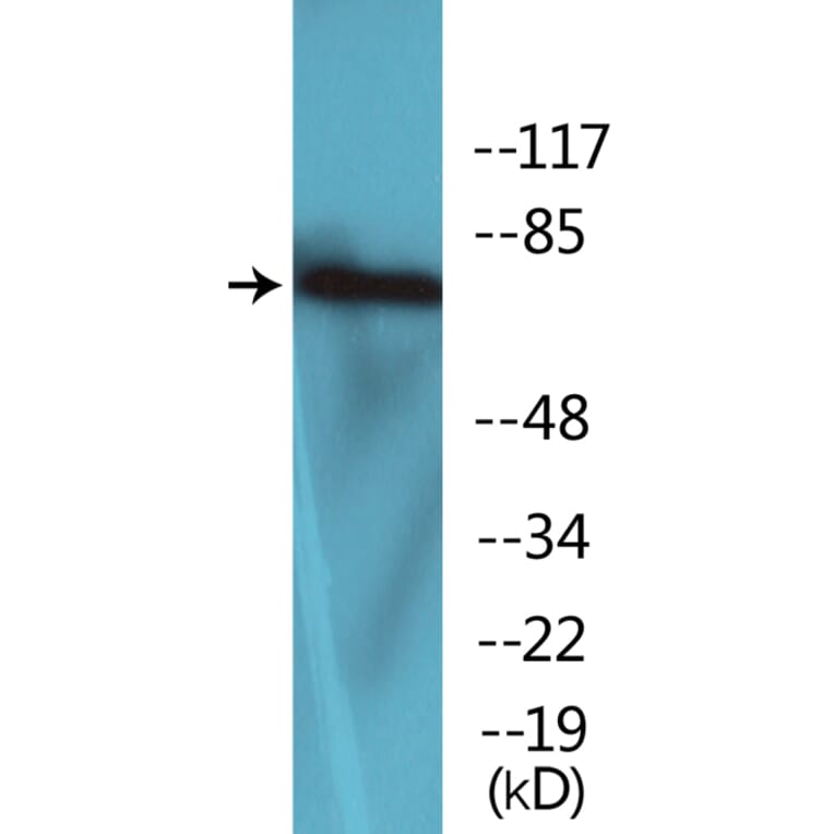 Western Blot - Anti-LIMK2 (phospho Thr505) Antibody (P12-1137) - Antibodies.com