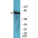 Western Blot - Anti-LIMK2 (phospho Thr505) Antibody (P12-1137) - Antibodies.com