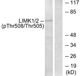 Western Blot - Anti-LIMK1 (phospho Thr508) Antibody (A7140) - Antibodies.com