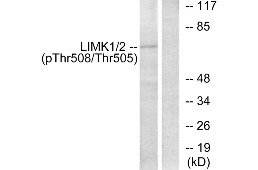 Western Blot - Anti-LIMK1 (phospho Thr508) Antibody (A7140) - Antibodies.com
