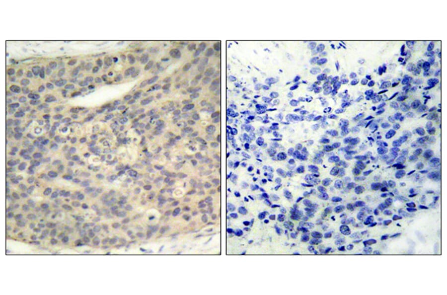 Immunohistochemistry - Anti-LIMK1 (phospho Thr508) Antibody (A7140) - Antibodies.com