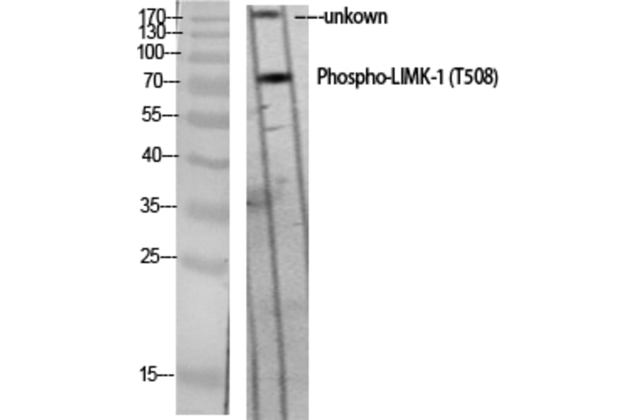 Western Blot - Anti-LIMK1 (phospho Thr508) Antibody (A7140) - Antibodies.com
