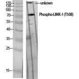 Western Blot - Anti-LIMK1 (phospho Thr508) Antibody (A7140) - Antibodies.com