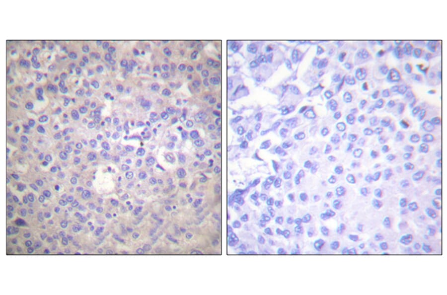 Immunohistochemistry - Anti-IRS-1 (phospho Ser612) Antibody (A0447) - Antibodies.com