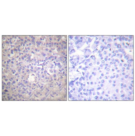 Immunohistochemistry - Anti-IRS-1 (phospho Ser612) Antibody (A0447) - Antibodies.com