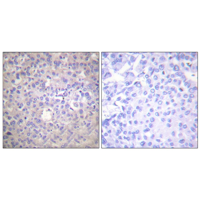 Immunohistochemistry - Anti-IRS-1 (phospho Ser612) Antibody (A0447) - Antibodies.com