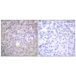 Immunohistochemistry - Anti-IRS-1 (phospho Ser612) Antibody (A0447) - Antibodies.com