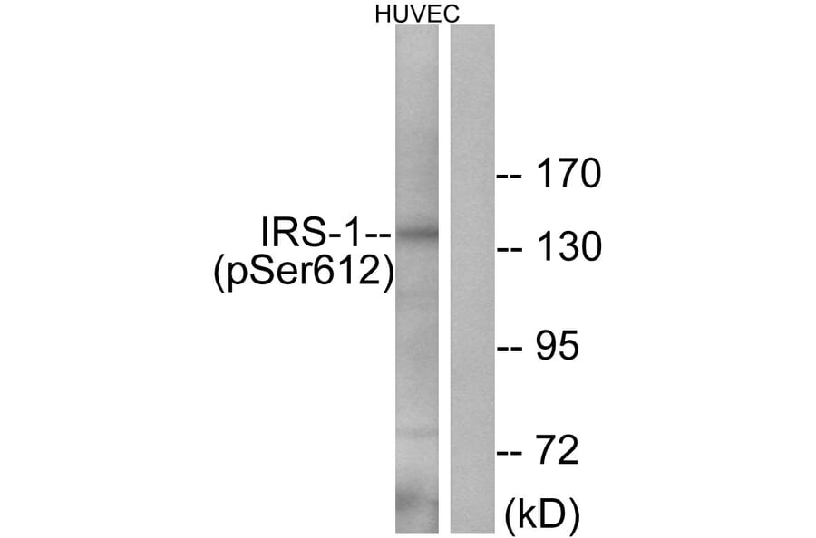 Western Blot - Anti-IRS-1 (phospho Ser612) Antibody (A0447) - Antibodies.com