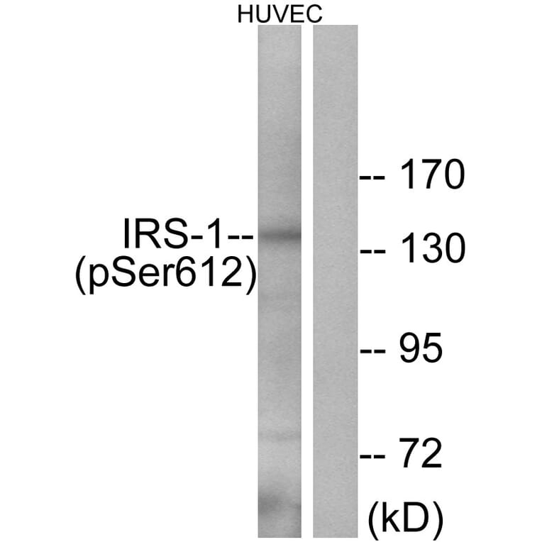 Western Blot - Anti-IRS-1 (phospho Ser612) Antibody (A0447) - Antibodies.com