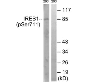 Western Blot - Anti-IREB1 (phospho Ser711) Antibody (A1075) - Antibodies.com