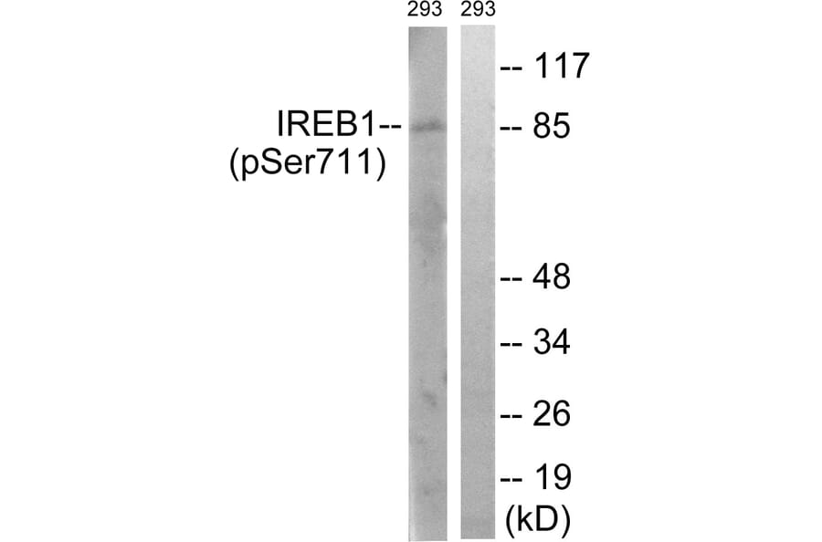 Western Blot - Anti-IREB1 (phospho Ser711) Antibody (A1075) - Antibodies.com