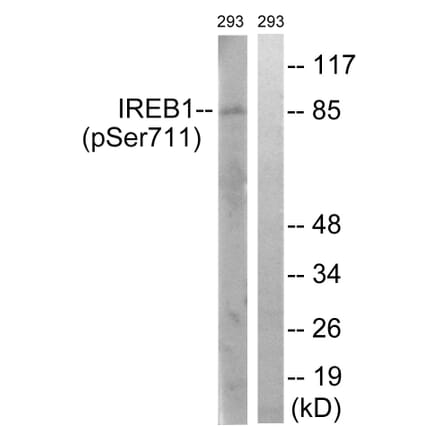 Western Blot - Anti-IREB1 (phospho Ser711) Antibody (A1075) - Antibodies.com