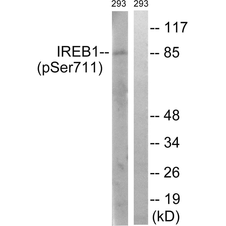 Western Blot - Anti-IREB1 (phospho Ser711) Antibody (A1075) - Antibodies.com