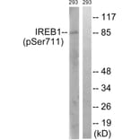 Western Blot - Anti-IREB1 (phospho Ser711) Antibody (A1075) - Antibodies.com