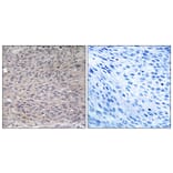 Immunohistochemistry - Anti-IREB1 (phospho Ser711) Antibody (A1075) - Antibodies.com